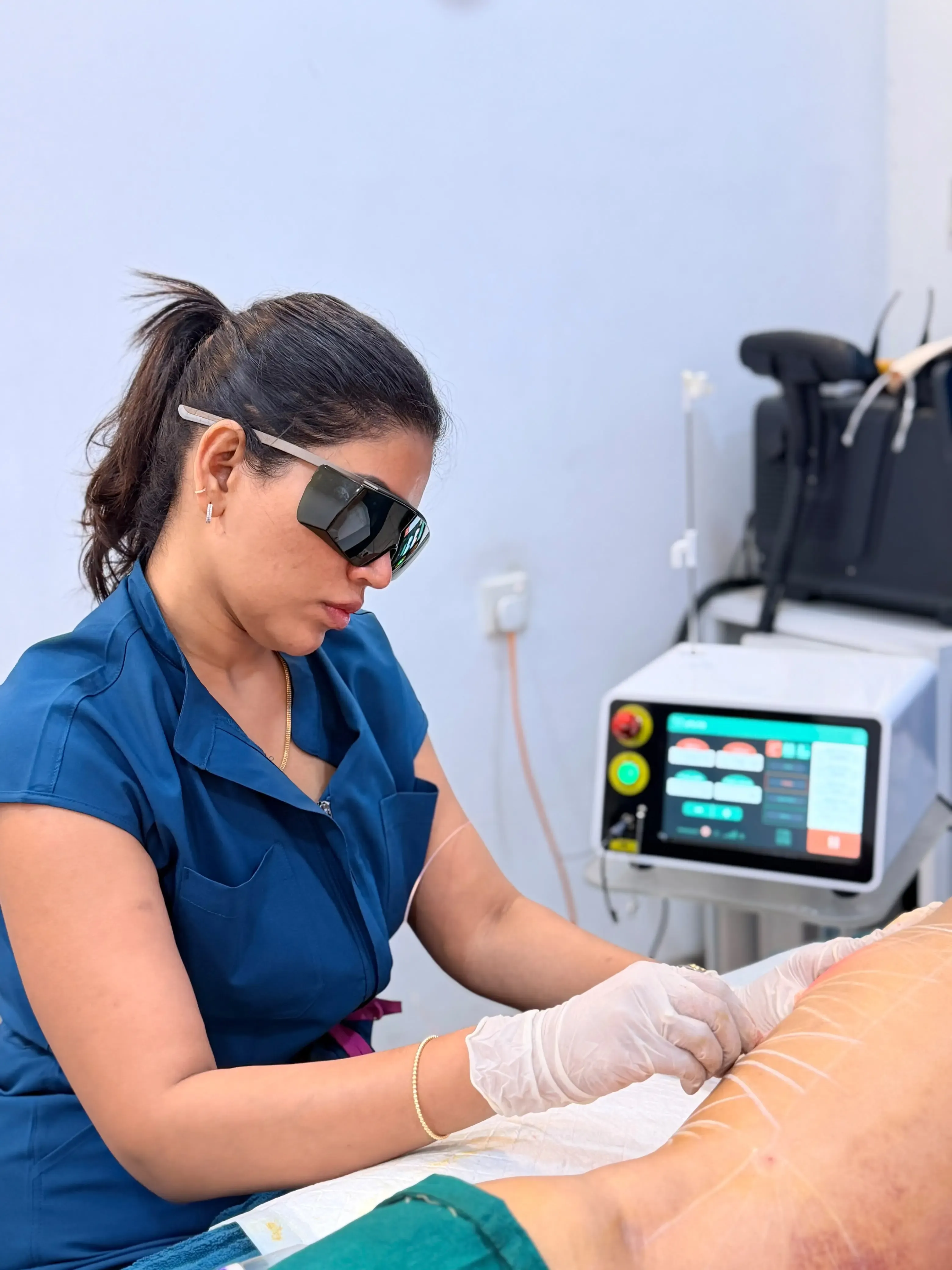 Dr Dineli performing an Endolift laser treatment at Luxskin clinic in Colombo, wearing protective eyewear while guiding the laser fibre along a marked treatment area